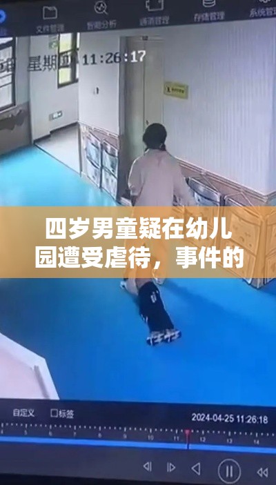 四岁男童疑在幼儿园遭受虐待，事件的背后与反思